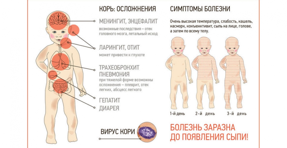 Рвота у матери и грудное вскармливание - Ла Лече Лига Россия
